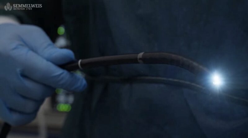 Gyomortükrözés közérthetően – így derülhet ki gyulladás, fekély vagy daganat